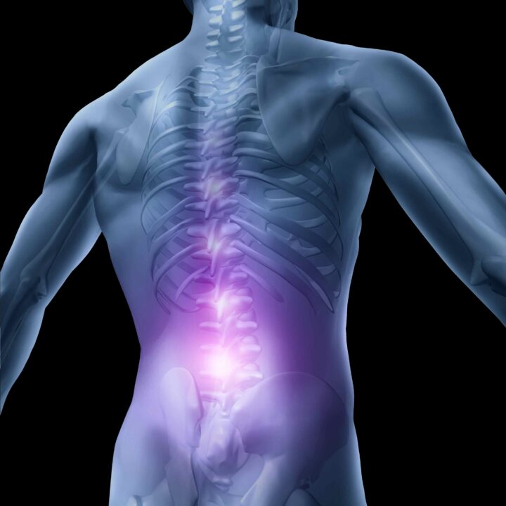 Movement and Chronic Low Back Pain, Online (Polestar Pilates)